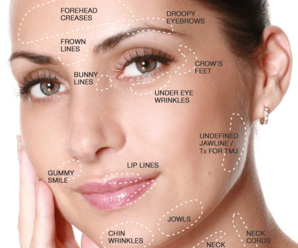 Naples+Facial+Injetions